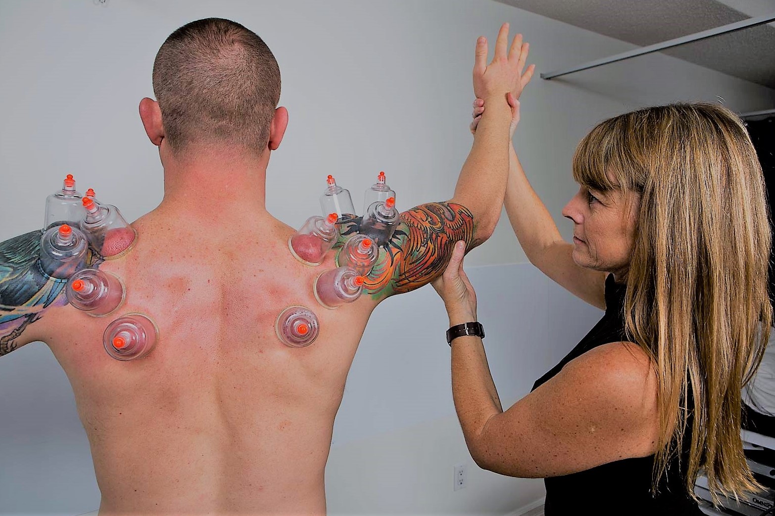 Cupping. What is it and how can it help you?